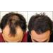 Nutrifolica Hair Loss Volumizing Conditioner 2 Month Supply | International Shipping Available - Buy Online on SooperMarket.com