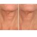 SiO Beauty Plunging Neckline - Overnight Silicone Smoothing Patches for Neck & Chest | Reusable SkinPad & Necklift - Shop Now - Buy Online on SooperMarket.com