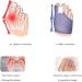 Kenanlan Bunion Corrector for Women - 2PC Toe Splints & Separators for Overlapping Big Toe - Universal Size - Buy Online on SooperMarket.com