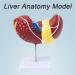 Teaching Model Human Liver Educational Model with Base and Clear Texture and Pathological Features Liver Cirrhosis Model for Medical School Study and Research - Buy Online on SooperMarket.com