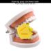 10pcs Dental Mouth Rest - Autoclave Silicone Tooth Bite Opener & Dental Retractor for Dentists - Premium Quality & Small Size - Buy Online on SooperMarket.com