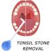 Manual Tonsil Stone Remover Tool for Adults | Mouth Cleaning Care & Ear Wax Removal | 1pcs Green - Buy Online on SooperMarket.com