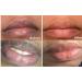Pink Fresh Lightening Cream & Blackish Green Balm Set for Dark Lip Removal - 2PC Treatment - Buy Online on SooperMarket.com