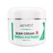 Scar Repair Cream Acne Scar Removal Pigmentation Corrector Remove Stretch Marks Smooth Skin Whitening Scar Care