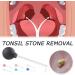 Manual Tonsil Stone Remover Tool for Adults | Mouth Cleaning Care & Ear Wax Removal | 1pcs Green - Buy Online on SooperMarket.com