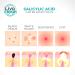 Livaclean (120 Count 3 Pack) Mixed bundle of Regular (48) Salicylic Acid (36) and T.Tree (36) Hydrocolloid Patches + 10 Count Large Square Patches 130 Count Mixed Pack - Buy Online on SooperMarket.com