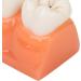 4-Fold Dental Caries Model - Synthetic Resin Oral Care Training Tool for Students | Safe & Realistic Simulation - Buy Online on SooperMarket.com