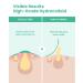GLAM UP Spotless Nose Patch XL - Hydrocolloid Treatment for Pores, Pimples & Blackheads - 12 Patches - Buy Online on SooperMarket.com