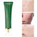 Acne Scar Removal Gel Face Body Marks Skin Repair Cream Acne Treatment Essence 30g acne removal cream - Buy Online on SooperMarket.com