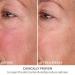 Dr. Dennis Gross DermInfusions Fill + Repair Serum - 1 oz | Fills Lines, Plumps, and Repairs - Buy Online on SooperMarket.com