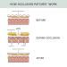 Buy Dermaclara Silicone Stretch Marks Patch Kit - Effective One Patch Solution for Scars | International Shipping Available - Buy Online on SooperMarket.com