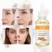 Turmeric face seruem Dark Spot Remover Essence Turmeric Serums for face Brightens Skin Tone Moisturizes Hydrates Lightens Age-Spots Acne Reduce Fine Lines Facial Care Anti-Aging Serum - Buy Online on SooperMarket.com