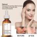 Retinol Serum For Face/Neck/Eyes - Retinol 1% in Squalane 30ml - High-Strength Face Serum for Activate Skin- Anti Aging Facial Serum for Moisturizing Fine Line Skin Repair - Buy Online on SooperMarket.com