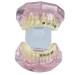 LBYLYH orthodontic demonstration model teeth teach study tools with metal and ceramic support for orthodontic dental treatment