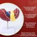 Teaching Model Human Liver Educational Model with Base and Clear Texture and Pathological Features Liver Cirrhosis Model for Medical School Study and Research - Buy Online on SooperMarket.com