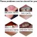 Snap on Smile Braces Instant Perfect Smile Temporary Replacement Tooth Kit for Broken Missing Teeth - Buy Online on SooperMarket.com