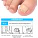 Toenail Patch Ingrown Toenail Toenail Correction Toenail Correction Patch Toenail Correction Patch Ingrown Toenail Nail Care 50 Pieces - Buy Online on SooperMarket.com