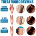 3 Pieces VeinHealing Varicose Vein Spray - Remove Varicose & Spider Veins Soothing Treatment for Legs 30ml | Improve Blood Circulation - Buy Online on SooperMarket.com
