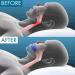 Anti Snoring Mouthpiece | Sleep Apneas Mouth Guard | The Quiet Soothie Snoring Mouth Guard | Sleep Apnea Snore Stopper Mouth Guard - Buy Online on SooperMarket.com