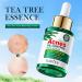 Tea Tree Oil for Face - Acne Serum & Blemish Spot Treatment - Unclogs Pores Soothes Breakouts - 1 fl oz for Smooth Glowing Skin - Buy Online on SooperMarket.com