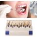 29 Color Porcelain Tooth Whitening Color Keys - Removable Tooth Elevation Table for Accurate Shade Matching - Buy Online on SooperMarket.com