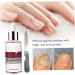 1PC Nail Treatment Nail Renewal Solution Toenails & Fingernails Nail Repairs Essential Oil Protects Toenail Fungus Treatment From Discoloration Brittle And Cracked Nail(12ML) - Buy Online on SooperMarket.com