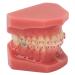 Orthodontic Demonstration Model for Dental Research | Metal Wires & Ceramic Brackets | Teaching Aids for Adults - Buy Internationally - Buy Online on SooperMarket.com