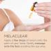 ISDIN Melaclear Dark Spot Correcting Serum - Vitamin C & Phytic Acid for Sensitive Skin - Buy Online on SooperMarket.com