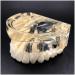 Implant Tooth Template Oral Simulation Dental Tooth Implant Simulation Dental Dental Oral Dental Study Model Teaching