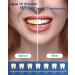 MySmile Teeth Whitening Kit with LED Light - Fast Non-Sensitive Whitener with 3 Carbamide Peroxide Gels - Remove Stains from Coffee, Smoking, Wine & Food - 10 Min Treatment - Buy Online on SooperMarket.com