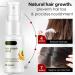 Hair Growth Serum Spray Hair Growth Accelerator Wild Growth Hair Ginger Oil for Hair Loss Treatments 20ML hair loss treatments - Buy Online on SooperMarket.com