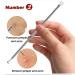 Ellolife 5-Pack Blackhead Remover Set - Stainless Steel Comedone Squeezer Kit for All Skin Types | Acne and Whitehead Extraction - Buy Online on SooperMarket.com