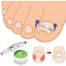 Ingrown Toenail Treatment Stainless Steel Ingrown Toenail Corrector Relief Paronychia Treatment Correcting Tool - Buy Online on SooperMarket.com