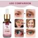 Eye Stye Remover for Fast Relief - Gentle Treatment for Styes  Chalazion  and Blepharitis - Buy Online on SooperMarket.com