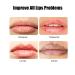 VERONNI 24K Gold Lip Mask - Hydrating Lip Plumper with 30 Patches for Smoother, Firmer Lips - Moisturizing and Nourishing Formula to Minimize Fine Lines - Buy Online on SooperMarket.com