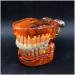 Transparent Dental Model for Adult Dentists | Realistic Teeth & Gums for Teaching & Demonstration - International Shipping - Buy Online on SooperMarket.com