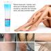 Varicose Vein Treatment Cream - Reduce Inflammation, Improve Circulation | Vein Lotion for Legs & Body - Buy Online on SooperMarket.com