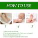 Urea Cream 40 Percent for Feet 40% Urea Cream for Cracked Heels and Dry Skin Aloe Vera Foot Cream with Tea Tree Oil Deep Moisturizing Callus Remover Nourishes Soften for Feet/Knees/Hands/Elbows - Buy Online on SooperMarket.com