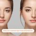 264 XL Invisible Eyelid Stripes - 2.8x0.4 cm with Tweezers | Slide Tapes for Perfect Eyelids - International Shipping - Buy Online on SooperMarket.com
