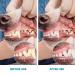 Pack of 4 Finger Toothbrushes for Dogs - Dental Care for Small Medium & Large Breeds - Buy Online on SooperMarket.com