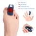 Claw Toe Corrector - Ergonomic Toe Straightener for Fracture Recovery | Breathable Strap for Fixation - Buy Online on SooperMarket.com