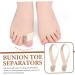 2pcs Toe Separator Set for Plantar Fasciitis, Hammer Toe, and Bunions - Pedicure Toe Separators for Women - 18.5x2.3cm - Buy Online on SooperMarket.com