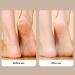 Electric Feet Callus Remover with 360 Head 3 Grinding Heads Ambient Lighting for Dead Hard Skin Pedicure Tool for Dry Feet Rechargeable Portable Electronic Foot File - Buy Online on SooperMarket.com
