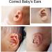 Silicone Auricle Correction Patch- Infant Ear Corrector Stickers, 4 x 50cm- Aesthetic Solution for Newborns and Kids - Buy Online on SooperMarket.com