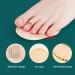 6 Piece Hammer Toe Straightener Set - Toe Splint for Crooked, Overlapping Toes & Corn Removers - Khaki, One Size - Buy Online on SooperMarket.com