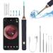 Ear Wax Removal- Ear Cleaner with Camera and Light  Wireless Ear Cleaning with 4 Earmuffs  Ear Wax Removal Tool with Built-in WiFi  Compatible with iPhone  Ipad and Android