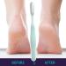 Pedicure Foot File | Toe Crevice Cleaning Brush Callus Remover Foot Scrubber Toe Crevice Cleaning Brush Foot Care Pedicure Tool Blue - Buy Online on SooperMarket.com