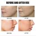 Rozino 3PC Face Serum Set | Advanced Collagen Boost Anti-Aging Solution for Glowing Skin - Buy Online on SooperMarket.com
