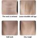 Face Lift Tape Invisible Face Lift Tape Anti Wrinkle Waterproof Small Tape for Lifting Enhancing Contours Instant Makeup Tape Lifting for Hide Wrinkles Double Chin Saggy - Buy Online on SooperMarket.com