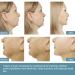 V-Line Masks | V Face Thin Mask for Chin Contour & Anti-Aging | Firming Moisturizing & Wrinkle Reduction - Buy Online on SooperMarket.com